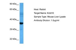 TNFAIP1 Rabbit anti-Mouse, Polyclonal, Novus Biologicals 0.1ml; Unconjugated:Antibodies,